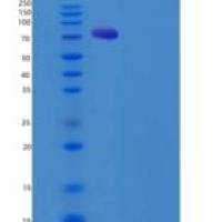 人磷酸二酯酶9A(PDE9A)重组蛋白His & GST tag