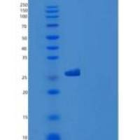 大鼠白介素9受体(IL9R)重组蛋白His tag