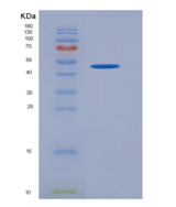 人KIR2DL1 / CD158a重组蛋白Fc tag