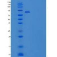 人内质网蛋白27(ERP27)重组蛋白Fc Tag