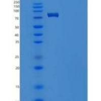 人STXBP1 / UNC18A重组蛋白His & GST tag