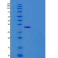 人Ⅸ型胶原α1(COL9a1)重组蛋白His Tag