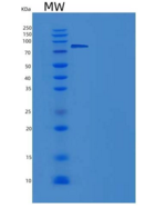 大鼠肝配蛋白A受体4(EPHA4)重组蛋白Fc tag