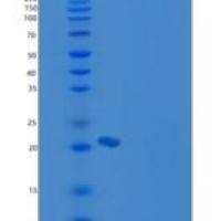 小鼠CD2 / LY37重组蛋白His tag