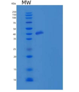 小鼠Carbonic Anhydrase IX / Car9
