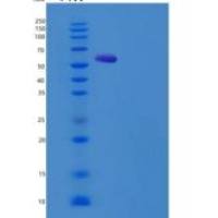 大鼠HepaCAM2重组蛋白Fc tag
