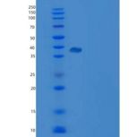 人四旋蛋白1(TSPAN1)重组蛋白aa 110-211, Fc tag