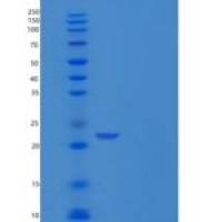 人血管内皮细胞蛋白C受体(EPCR)重组蛋白His Tag