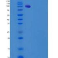 人GRK2 / ADRBK1重组蛋白His & GST tag