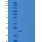 人REG1B / PSPS2重组蛋白His tag