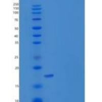 人REG1B / PSPS2重组蛋白His tag