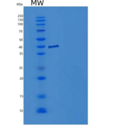 人IL-1R8 / IL1RAPL1重组蛋白His tag