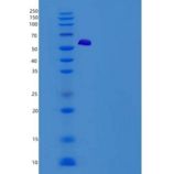 人TWF1 / PTK9 / Twinfilin-1重组蛋白His & GST tag