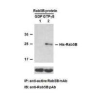 Rab5B Activation Assay Kit