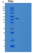人NSE / ENO2 / Enolase 2重组蛋白His