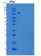 人Endoglin / CD105 / ENG重组蛋白Fc 