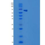 小鼠IL1R2 / CD121b重组蛋白Fc tag