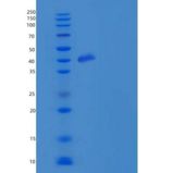 小鼠Carbonic Anhydrase IX / Car9重组蛋白His tag