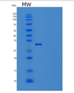 人SCARB3重组蛋白His tag
