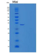 小鼠Carbonic Anhydrase II / Car2