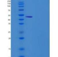 人TEM7 / PLXDC1重组蛋白His tag
