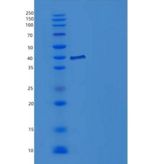 人IL-1R8 / IL1RAPL1重组蛋白His tag