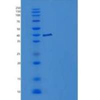 人IL-1R8 / IL1RAPL1重组蛋白His tag