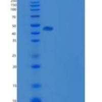 人高尔基磷酸化蛋白2(GOLPH2)重组蛋白His Tag