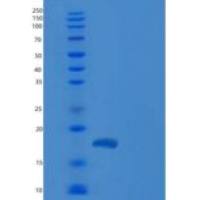 人CGB7重组蛋白His tag