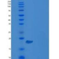 人CDC42BPB重组蛋白His & GST tag