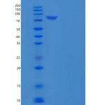 小鼠N-酰基鞘氨醇酰胺水解酶2(ASAH2)重组蛋白His tag