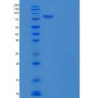 小鼠N-酰基鞘氨醇酰胺水解酶2(ASAH2)重组蛋白His tag