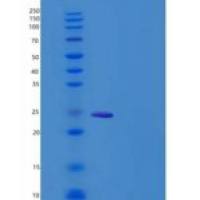 人CLM-9重组蛋白