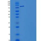 小鼠肝配蛋白A受体3(EPHA3)重组蛋白Fc tag