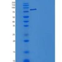 小鼠肝配蛋白A受体3(EPHA3)重组蛋白Fc tag