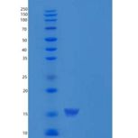 人ERP72 / PDIA4重组蛋白His tag