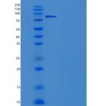 大鼠肝配蛋白A受体4(EPHA4)重组蛋白Fc tag