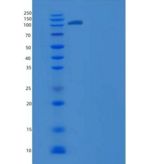 人含WW域E3泛素蛋白连接酶2(WWP2)重组蛋白His & GST tag