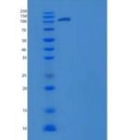 人含WW域E3泛素蛋白连接酶2(WWP2)重组蛋白His & GST tag