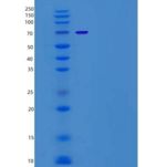 小鼠MKK4 / MEK4 / MAP2K4重组蛋白His & GST tag
