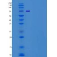 小鼠MKK4 / MEK4 / MAP2K4重组蛋白His & GST tag