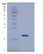 人超氧化物歧化酶1(SOD1)重组蛋白