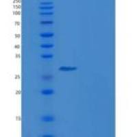 人β淀粉样蛋白42重组蛋白His & GST tag
