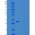 人CSRP1 / CSRP / CRP1重组蛋白His tag