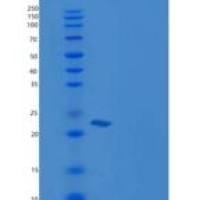 人CSRP1 / CSRP / CRP1重组蛋白His tag