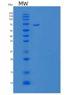 人GRK5 / GPRK5重组蛋白His tag