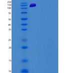 小鼠PKC delta / PRKCD重组蛋白His & GST tag