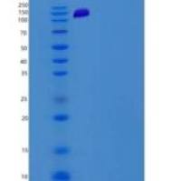 小鼠PKC delta / PRKCD重组蛋白His & GST tag