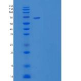 人GRK5 / GPRK5重组蛋白His tag