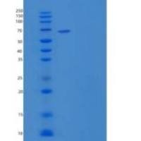 人GRK5 / GPRK5重组蛋白His tag